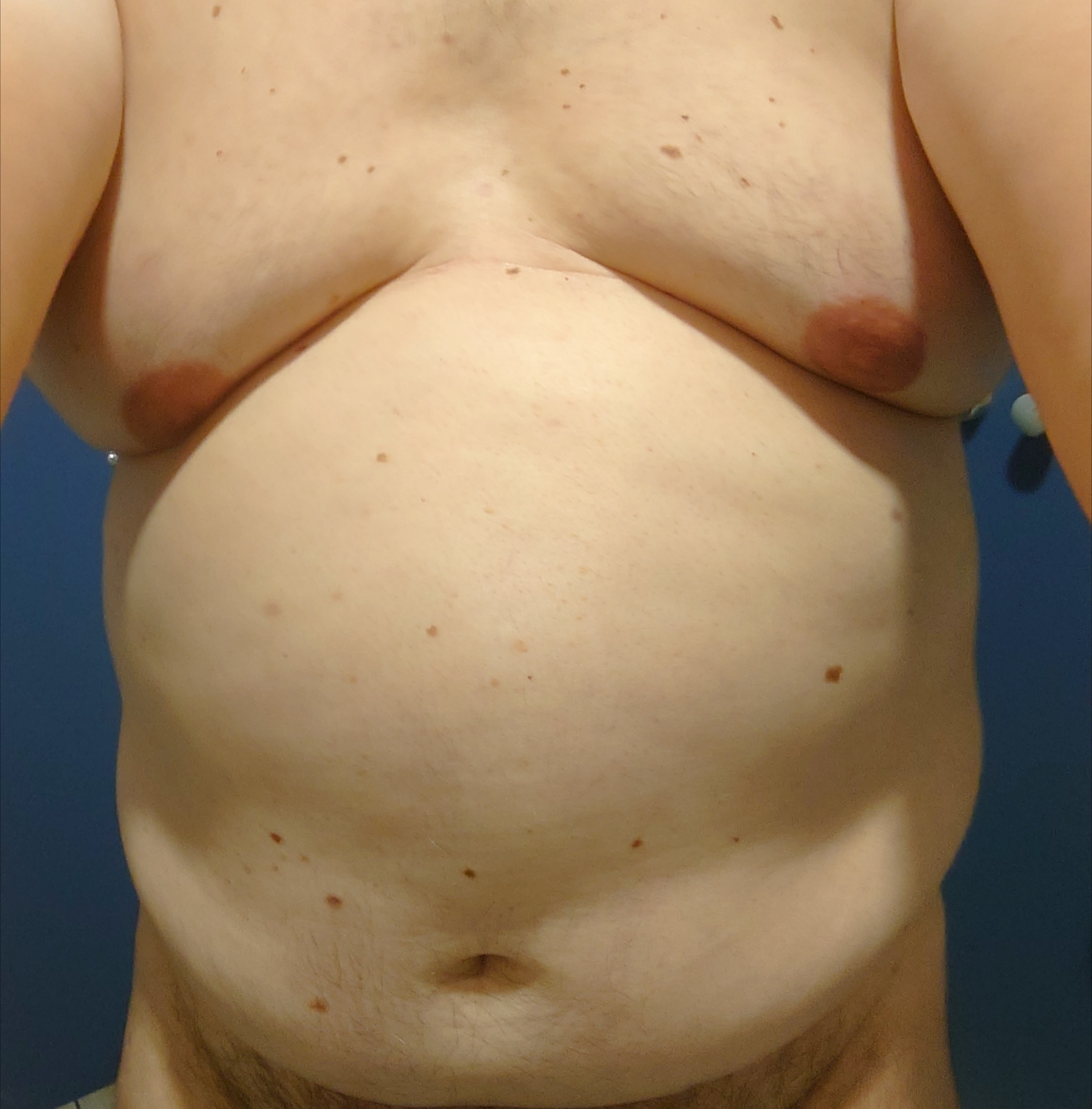 Folco - Vorselaar - Anvers | Rencontre Discrète